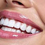 Teeth Whitening: Tips for a Brighter Smile at Home or Dentist 4 home and dentist whitening